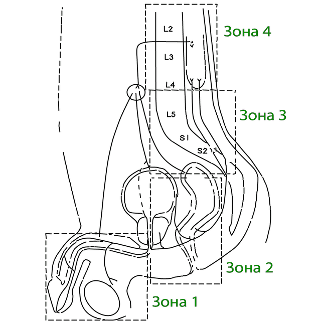 Схема возможных зон нарушений при синдроме Hard-Flaccid